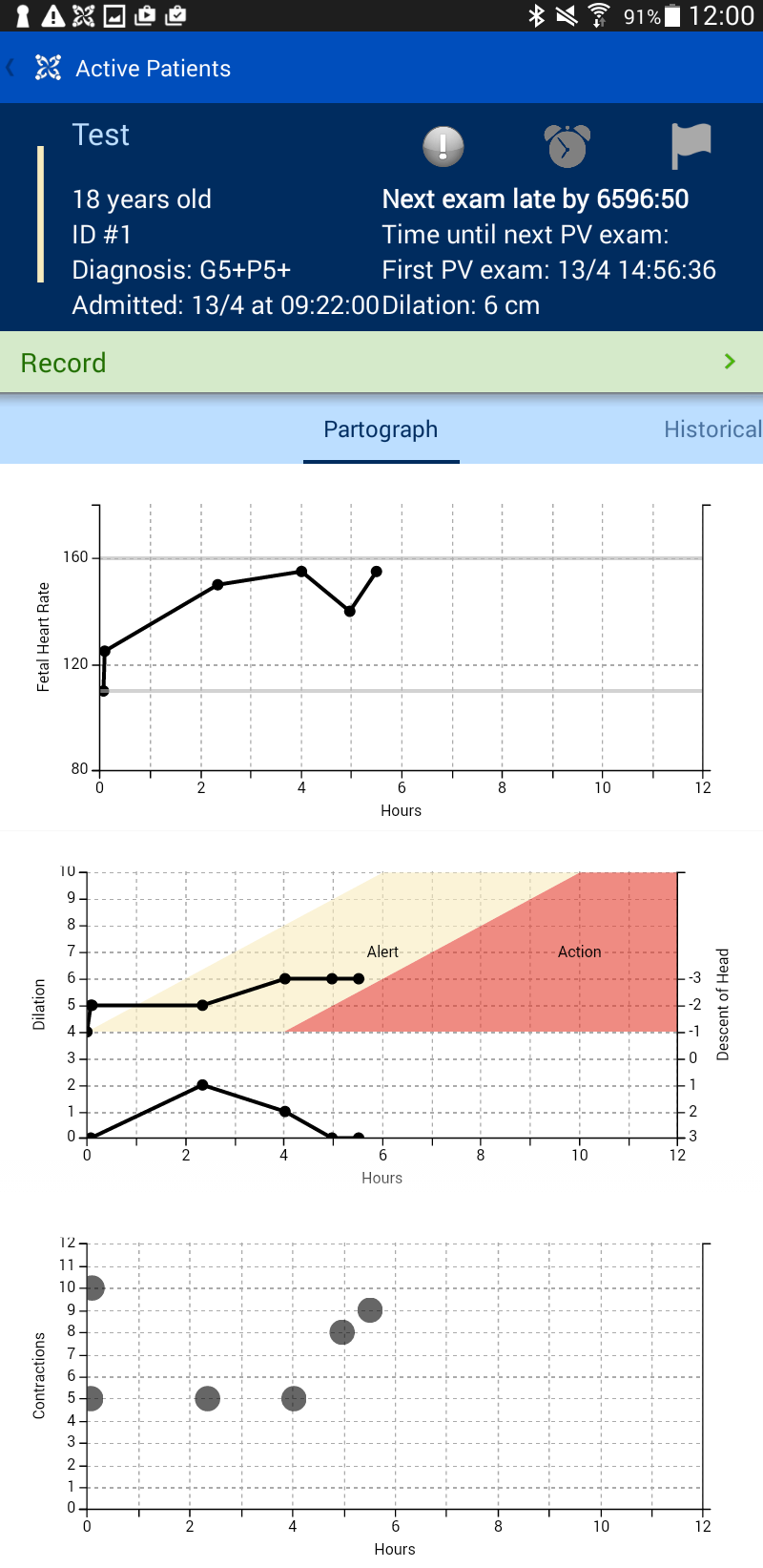 partograph, later