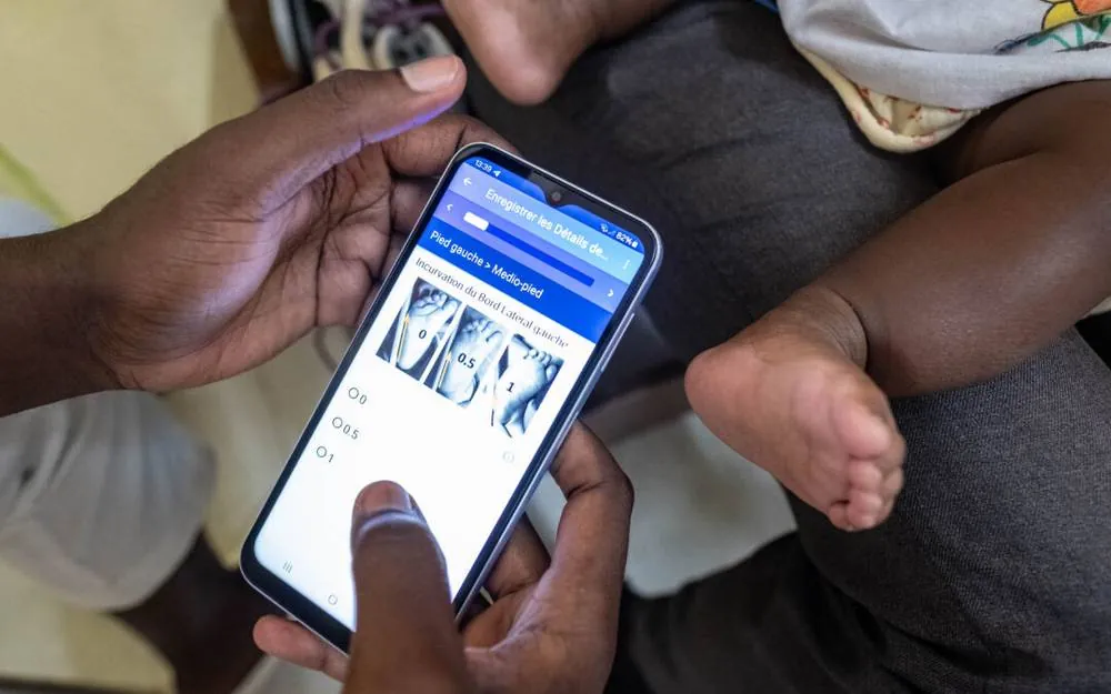 MiracleFeet CHW using CommCare CAST app to assess a child